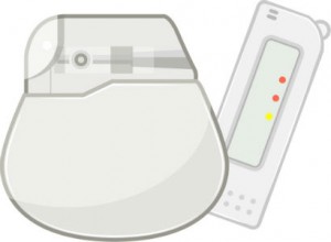 不整脈,ペースメーカー