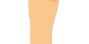 アトピー性皮膚炎治療の名医 専門医37名 日本全国の名医 専門医一覧まとめ